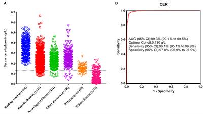 Role of serum ceruloplasmin in the diagnosis of Wilson's disease: A large Chinese study